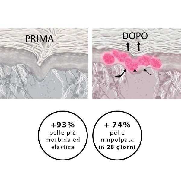 NOVEXPERT | Serum Booster a l'Acide Hyaluronique 10 ML |  Siero viso Acido Ialuronico MINISIZE