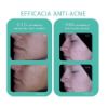 Gel detergente viso pelle impura MINI SIZE Trio Zinc Novexpert | Gelée moussante peau nette MINI SIZE Trio Zinc